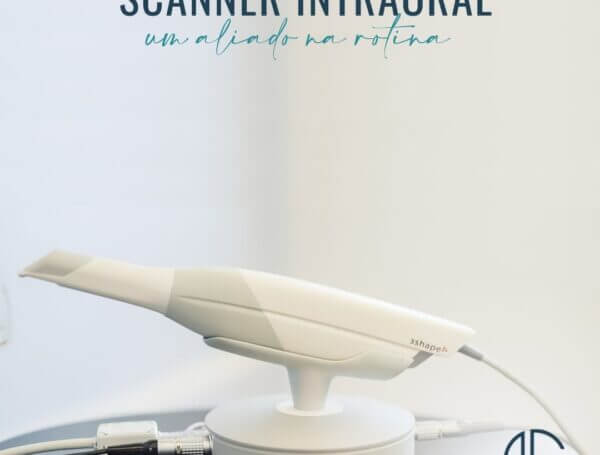 SCANNER INTRAORAL: UM ALIADO NA ROTINA