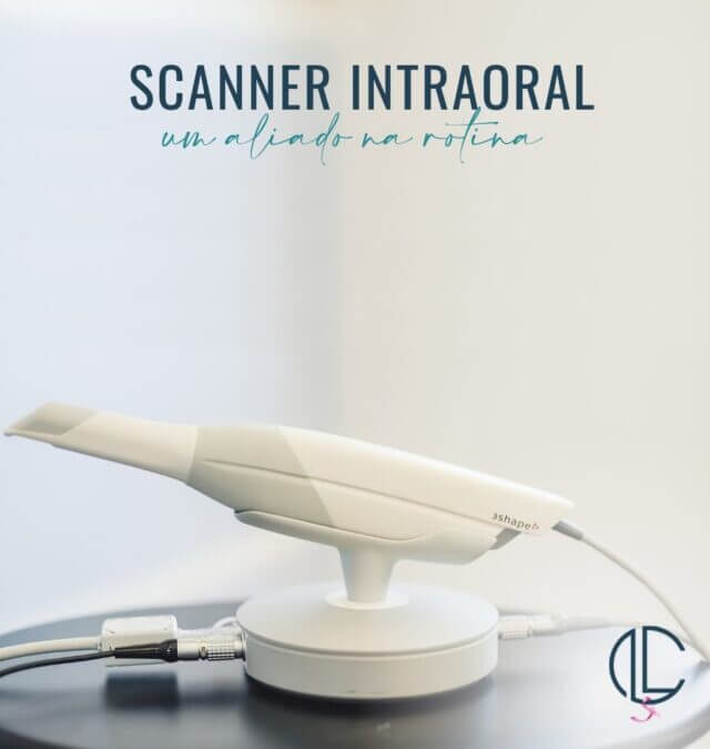 SCANNER INTRAORAL: UM ALIADO NA ROTINA