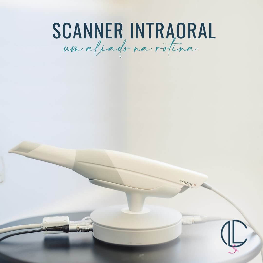 SCANNER INTRAORAL: UM ALIADO NA ROTINA