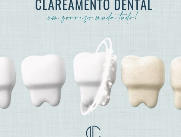 CLAREAMENTO DENTAL: UM SORRISO MUDA TUDO