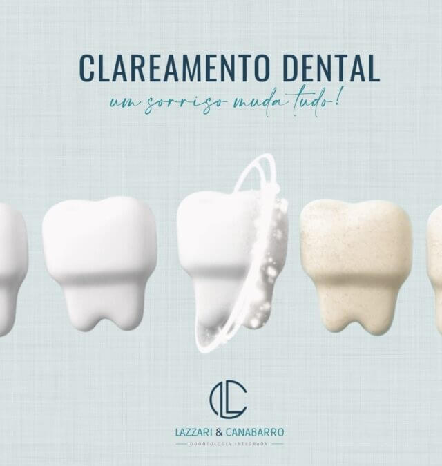 CLAREAMENTO DENTAL: UM SORRISO MUDA TUDO