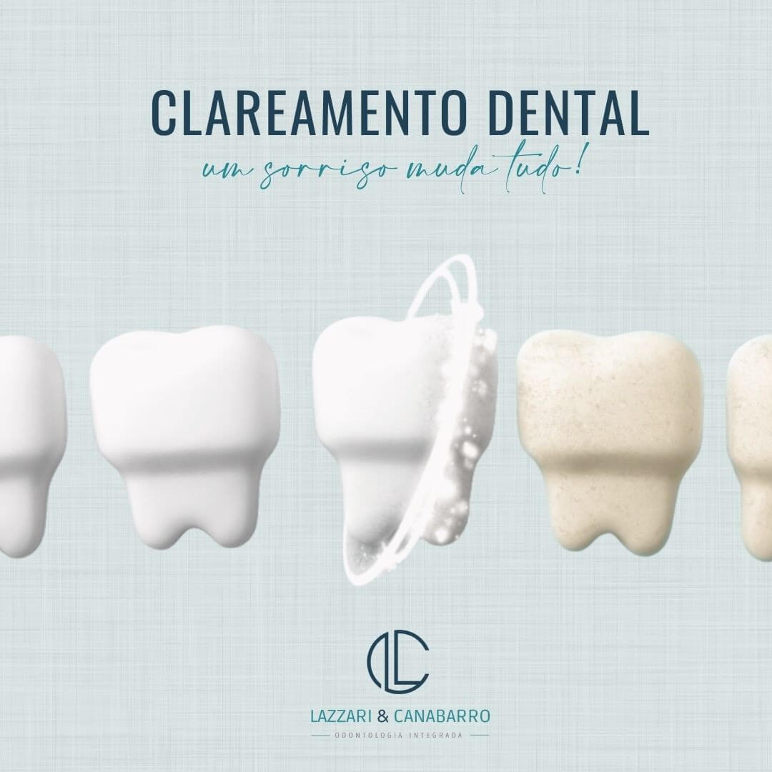 CLAREAMENTO DENTAL: UM SORRISO MUDA TUDO