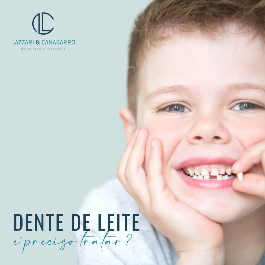 DENTE DE LEITE: É PRECISO TRATAR?