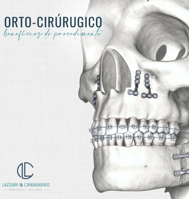 ORTO- CIRÚRGICO: BENEFÍCIOS DO PROCEDIMENTO