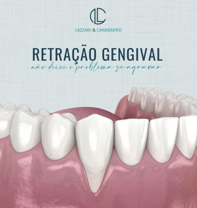 RETRAÇÃO GENGIVAL