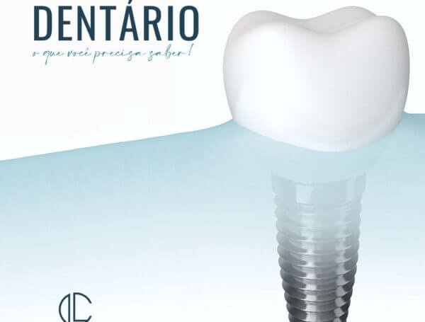 IMPLANTE DENTÁRIO