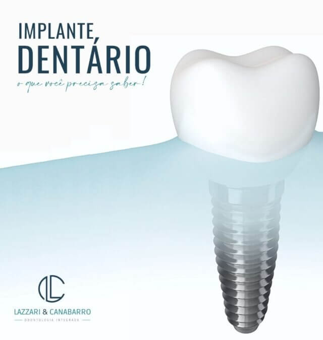 IMPLANTE DENTÁRIO