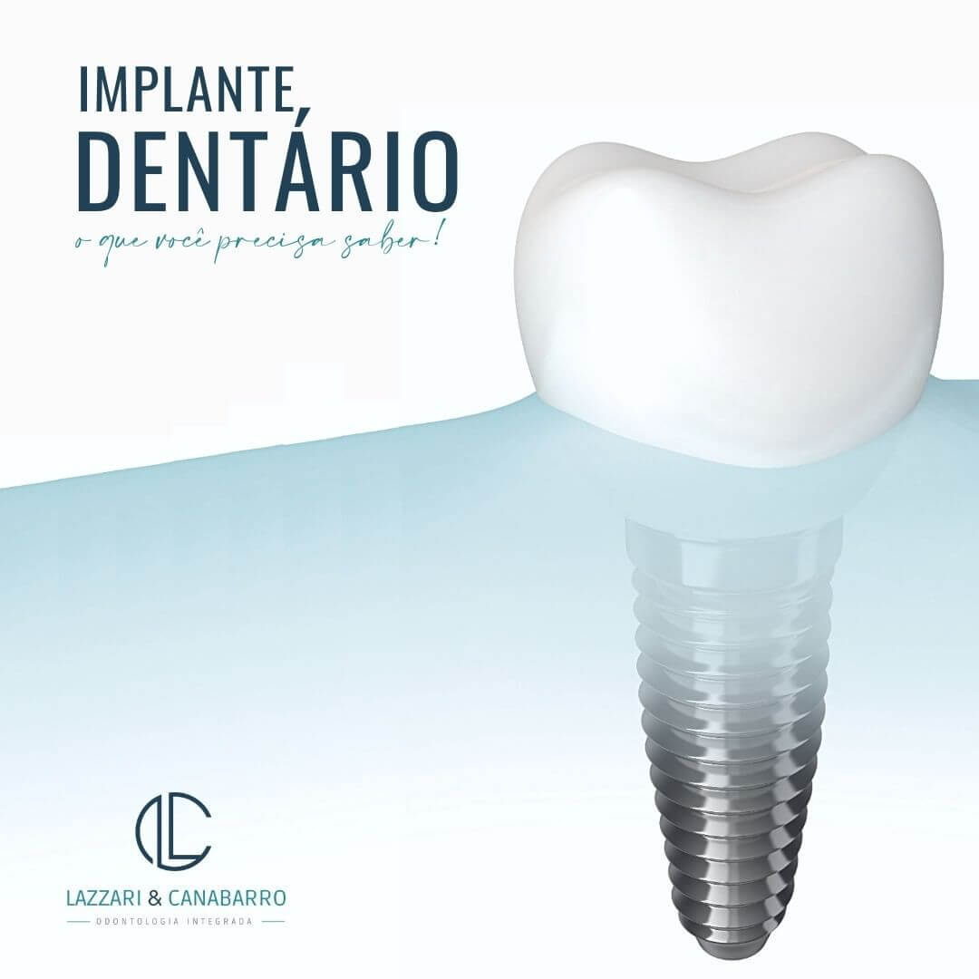 IMPLANTE DENTÁRIO