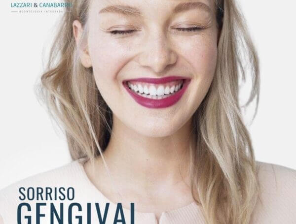 SORRISO GENGIVAL