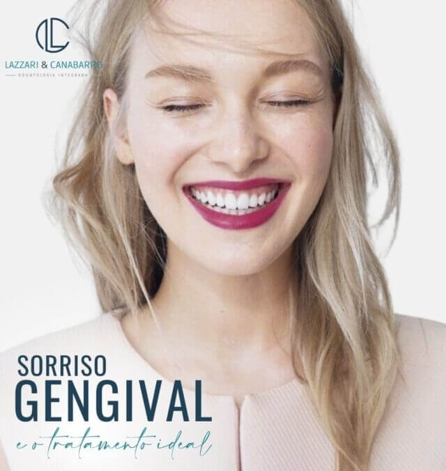 SORRISO GENGIVAL