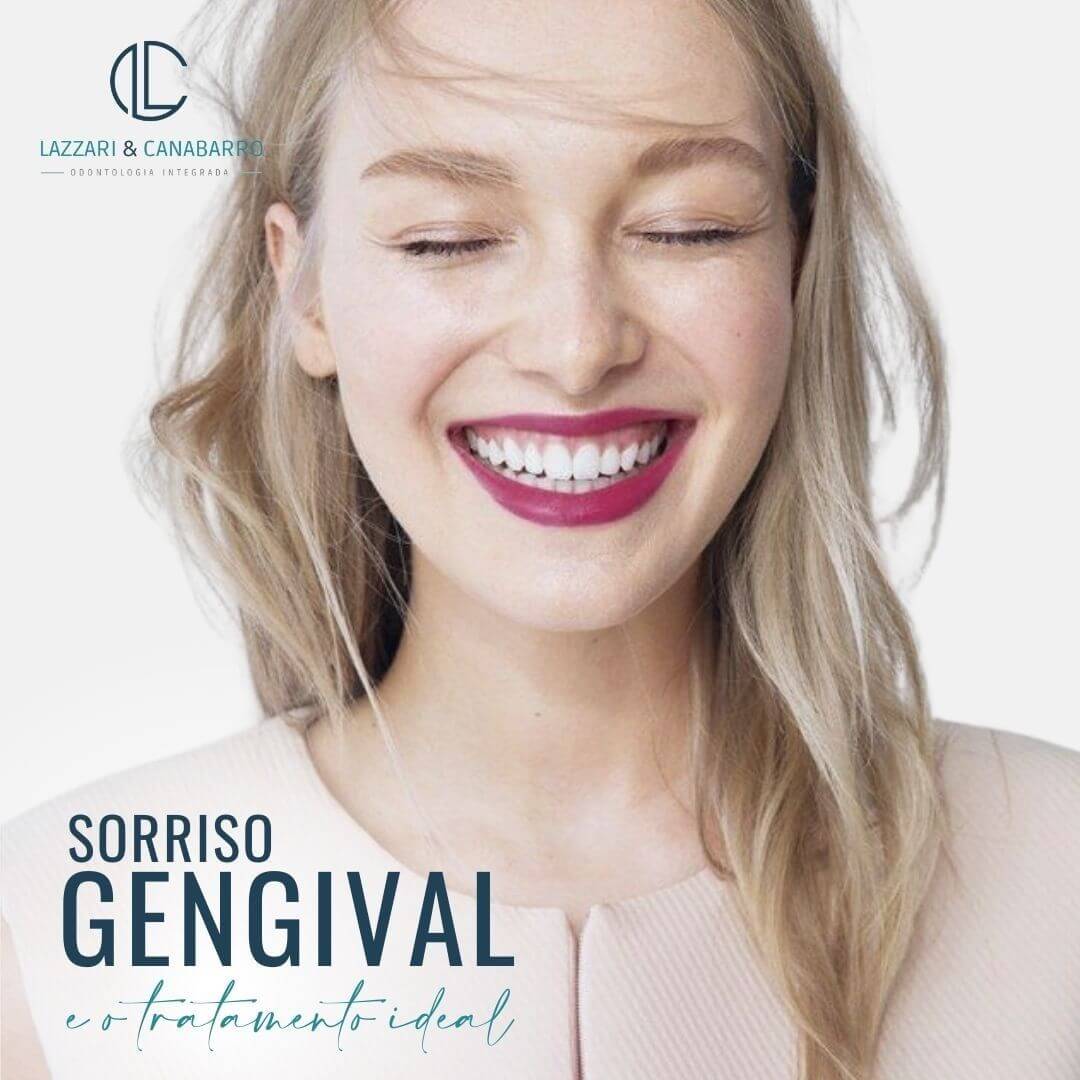 SORRISO GENGIVAL