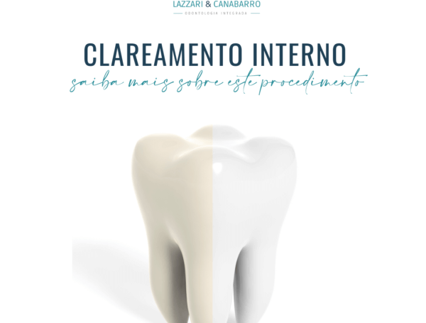 CLAREAMENTO INTERNO