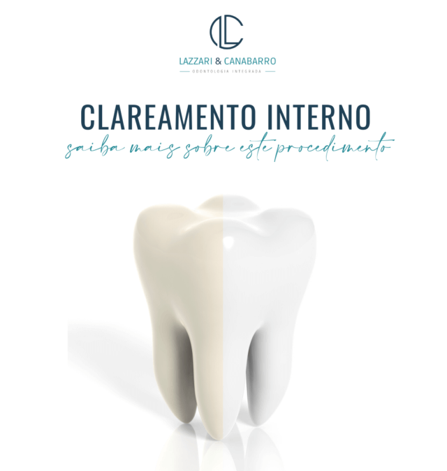 CLAREAMENTO INTERNO