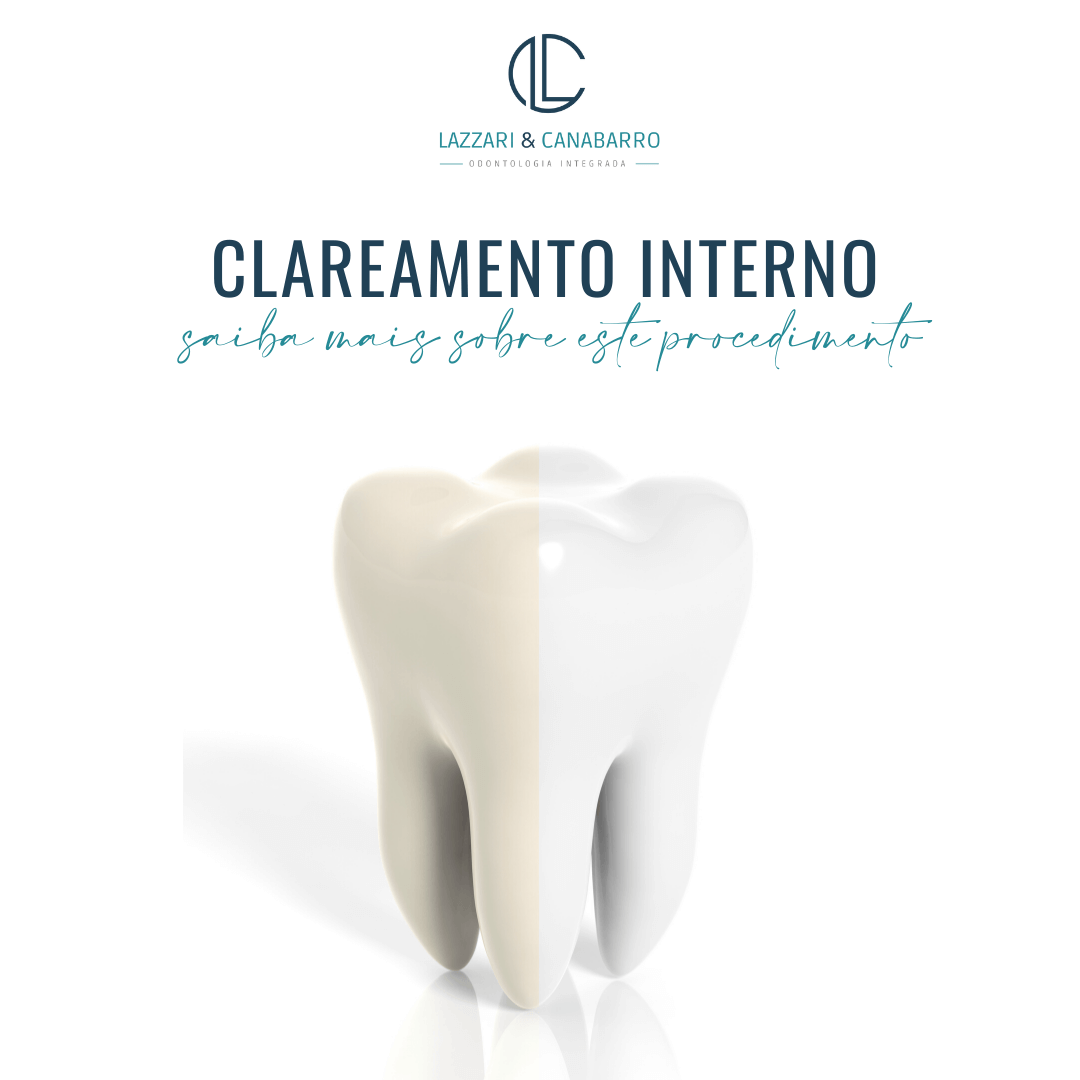 CLAREAMENTO INTERNO